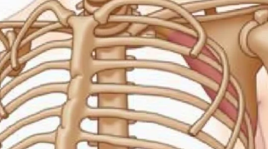 possible-causes-of-a-lump-on-the-rib-bone